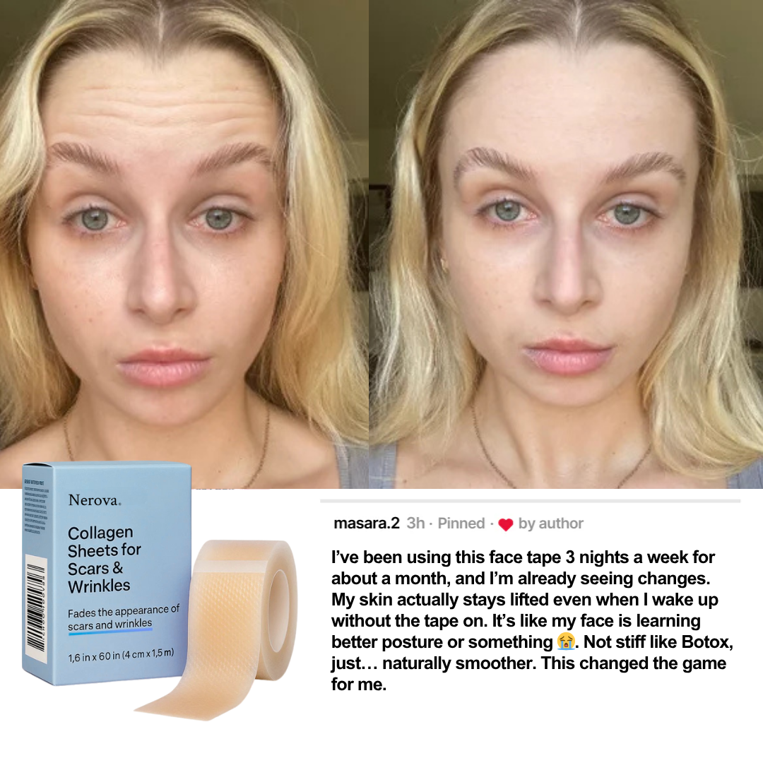 Nerova Beauty Sleep Tape