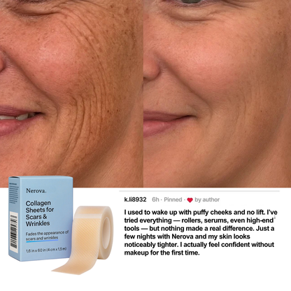 Nerova Beauty Sleep Tape